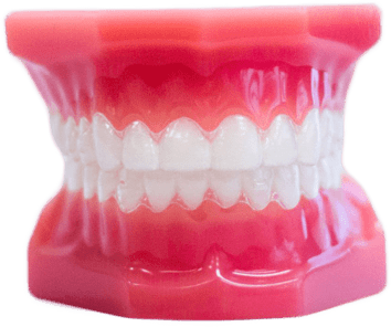 invisalign aligners on plastic model