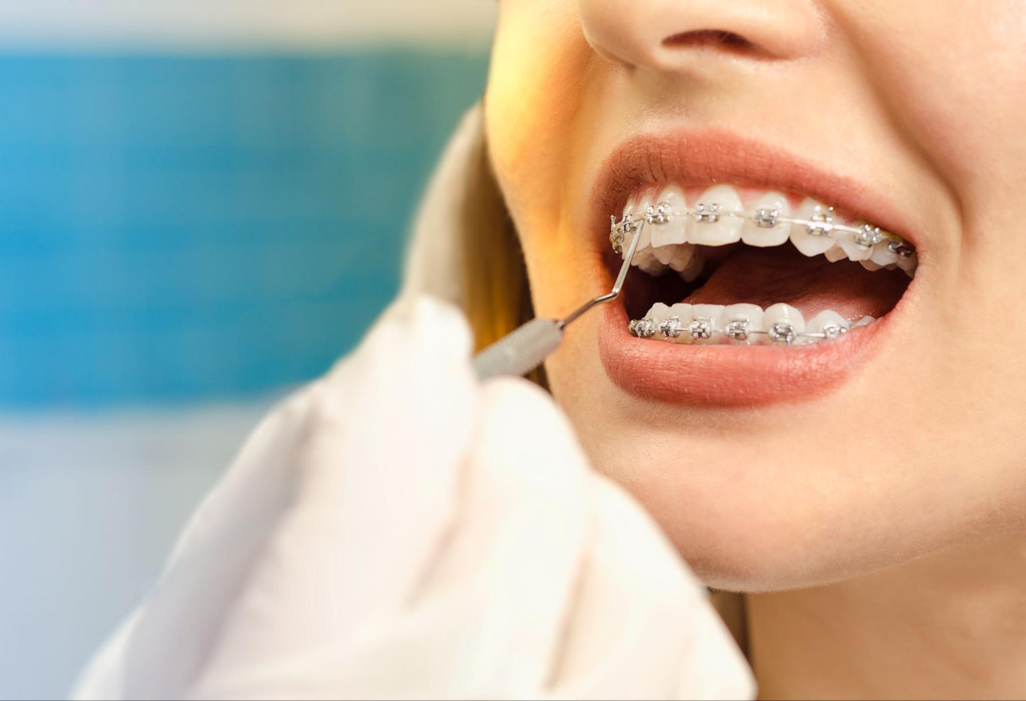 Does Orthodontic Treatment Hurt?