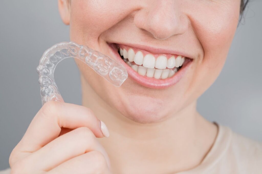 Everything You Need to Know About Retainers