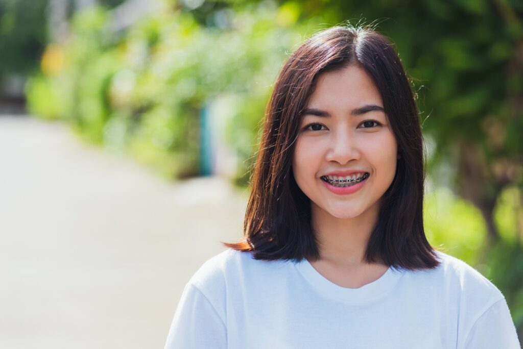 Braces for Adults: What to Expect